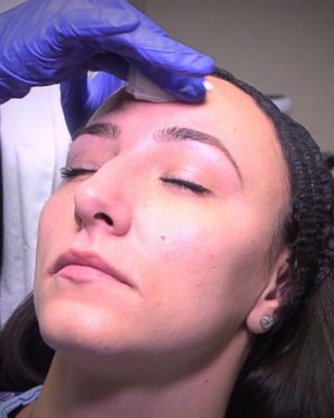 VIDEO: Experts Warn of Risks of Some At-Home Chemical Peels