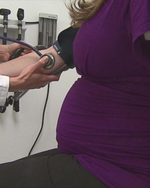 VIDEO: New study finds link between C-sections and hysterectomy complications later in life