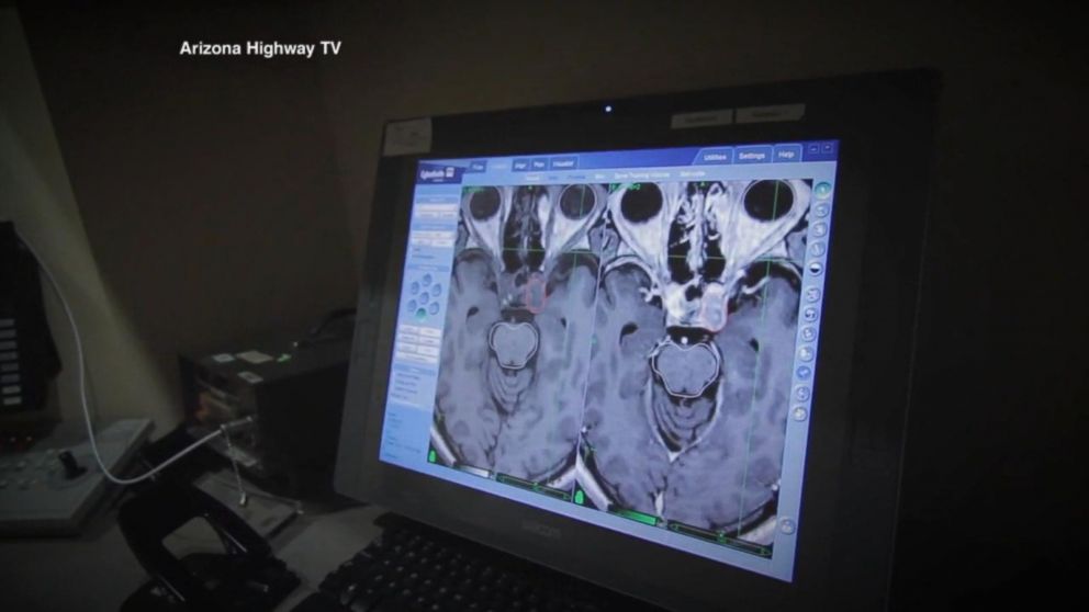VIDEO: What parents should know about a new survey on concussions and sports  
