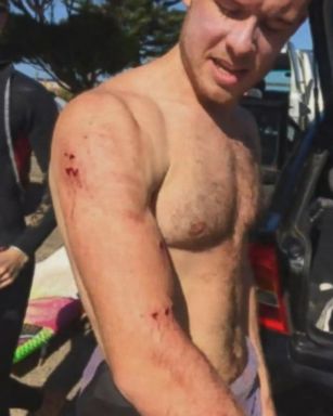 VIDEO: Surfer punches shark in face to escape attack 