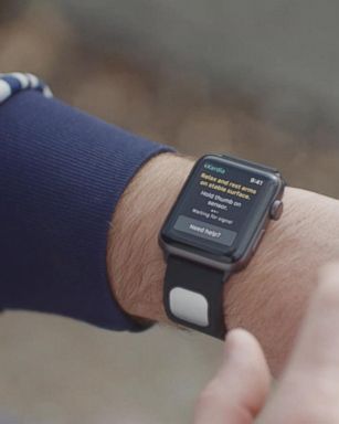 VIDEO: FDA clears EKG reader for Apple watch