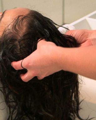 VIDEO: What to know about the new beauty trend of scalp facials 