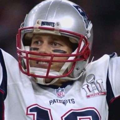 VIDEO: 'GMA' Hot List: Patriots fan offers Tom Brady his right hand to play