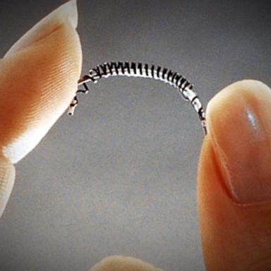 VIDEO: Bayer to no longer sell permanent birth control implant Essure