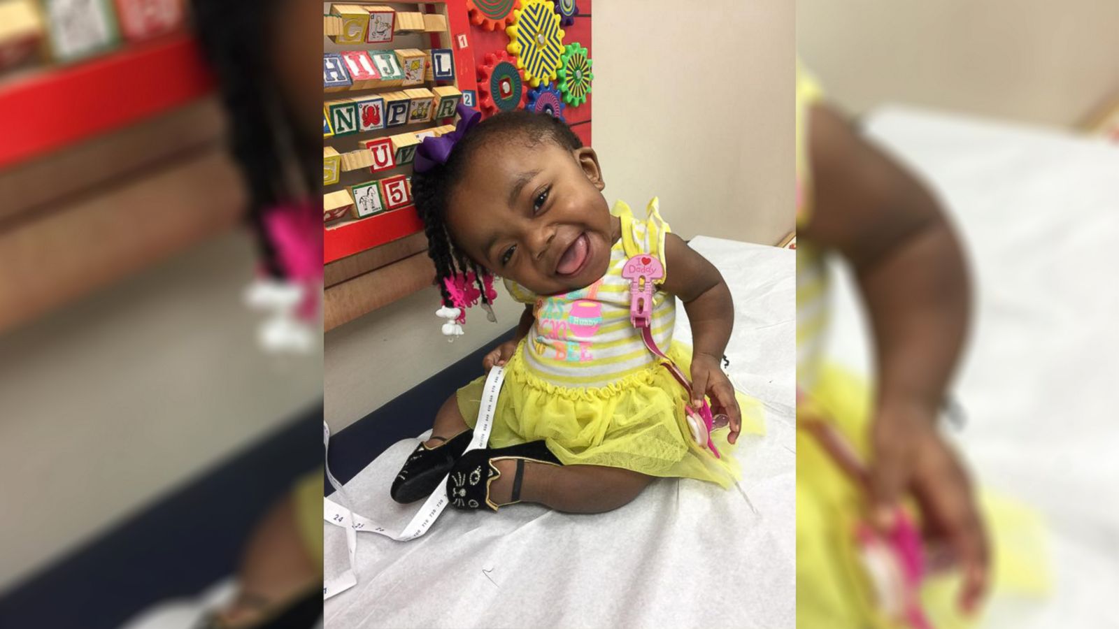 VIDEO: Spunky 3-year-old won't let her condition stop her from spreading smiles