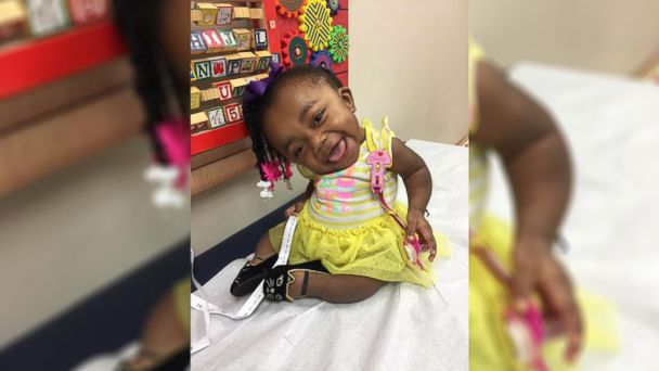 This spunky 3 year old won t let her condition stop her from