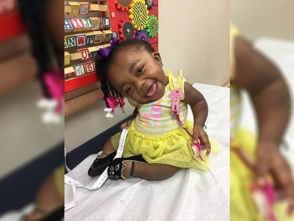 This spunky 3 year old won t let her condition stop her from