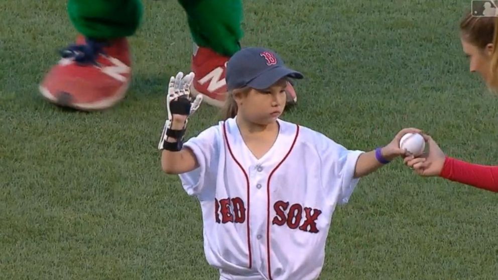 VIDEO: Girl with 3D-printed hand throws 1st pitch at all 30 MLB ballparks     