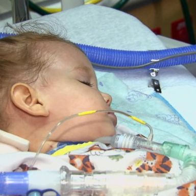 VIDEO: The latest on the polio-like illness afflicting kids in clusters 