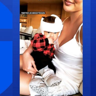 VIDEO: Chrissy Teigen responds to backlash over photo of her baby in a helmet 