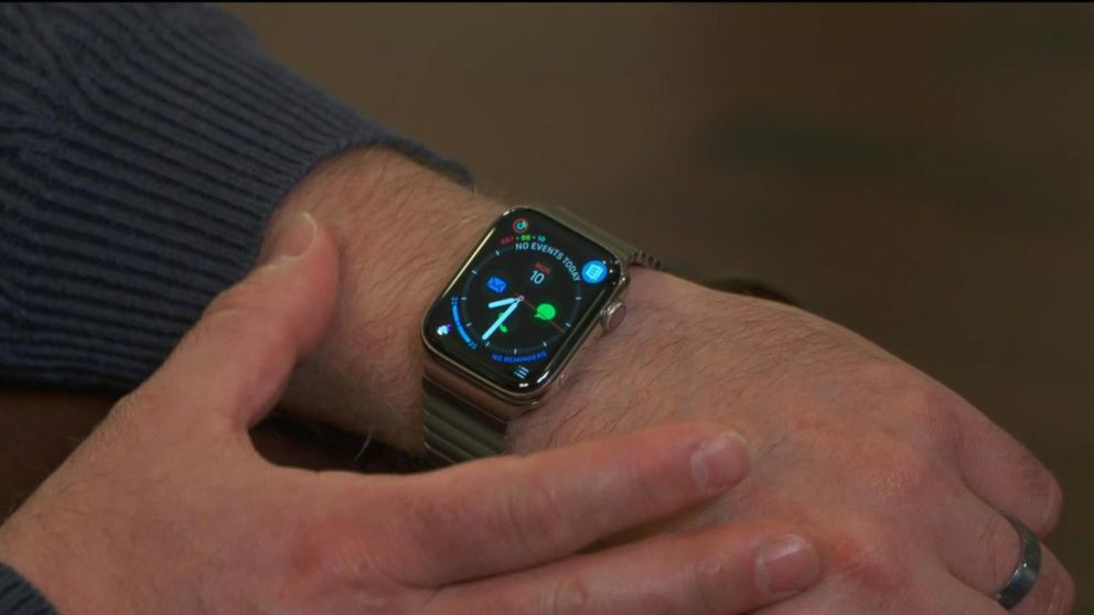 fido iwatch