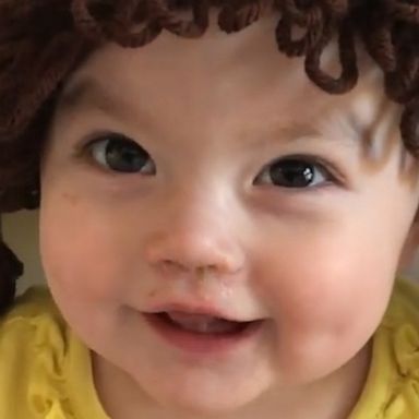 VIDEO: This Cabbage Patch cutie is all you need today