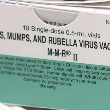 VIDEO: What to know about the Los Angeles measles quarantine