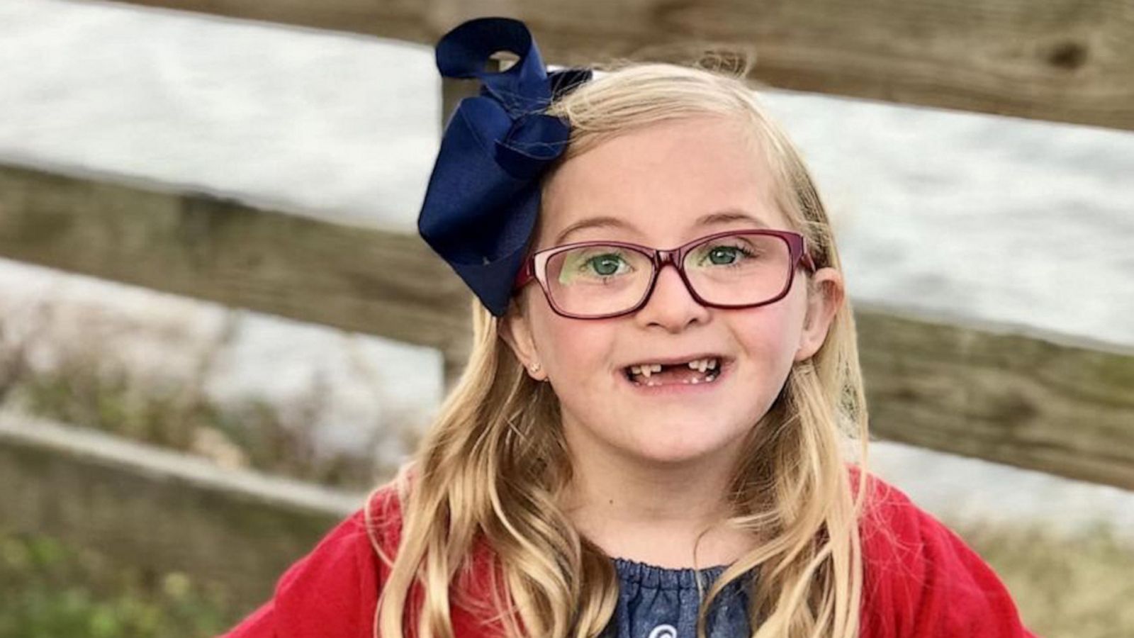 VIDEO: 7-year-old shares her thoughts about having Down syndrome