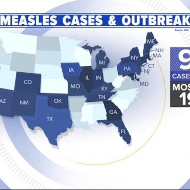 VIDEO: Alarming new numbers in the measles outbreak 