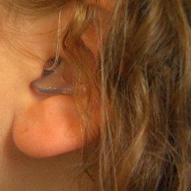 VIDEO: How parents are fighting to get insurance to cover hearing aids