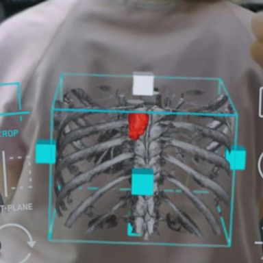 VIDEO: How 5G technology is changing the field of medicine