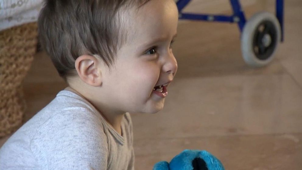 VIDEO: How toddler overcame spina bifida and is now walking  