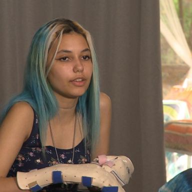 VIDEO: Teen shark bite victim opens up about 'healing' after losing her leg 