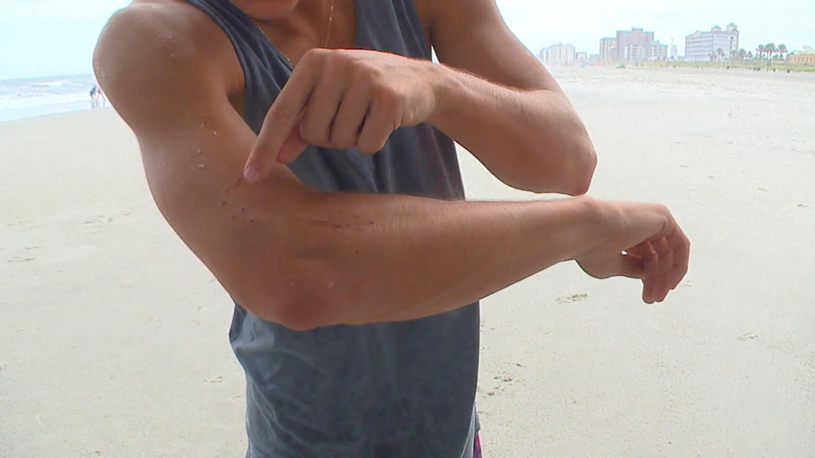 Surfers Shark Bite Caught On Camera Off Florida Coast Good Morning