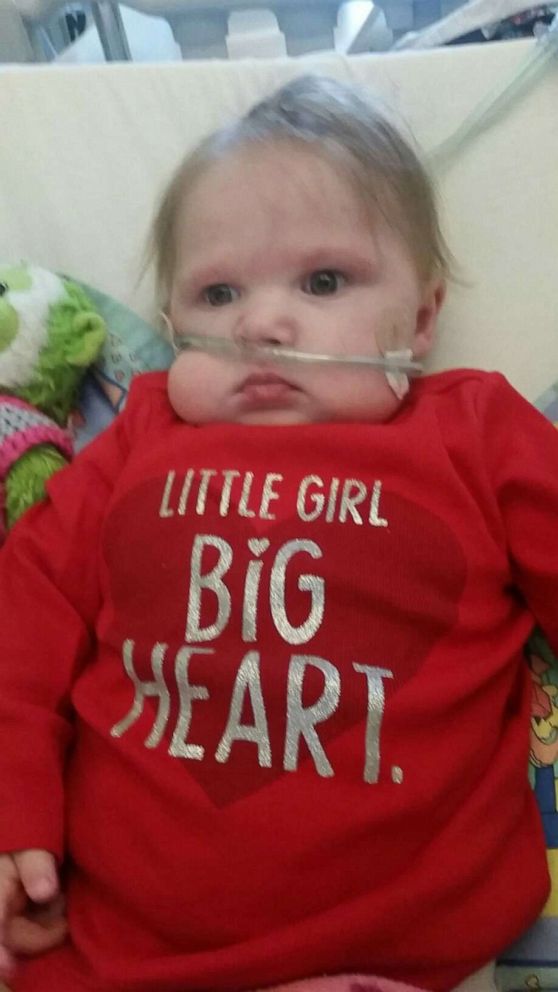 PHOTO: Lola Bond was the recipient of a life-saving heart transplant. 