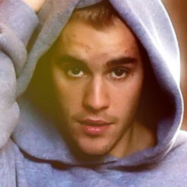 VIDEO: Justin Bieber talks drug abuse in Instagram post 