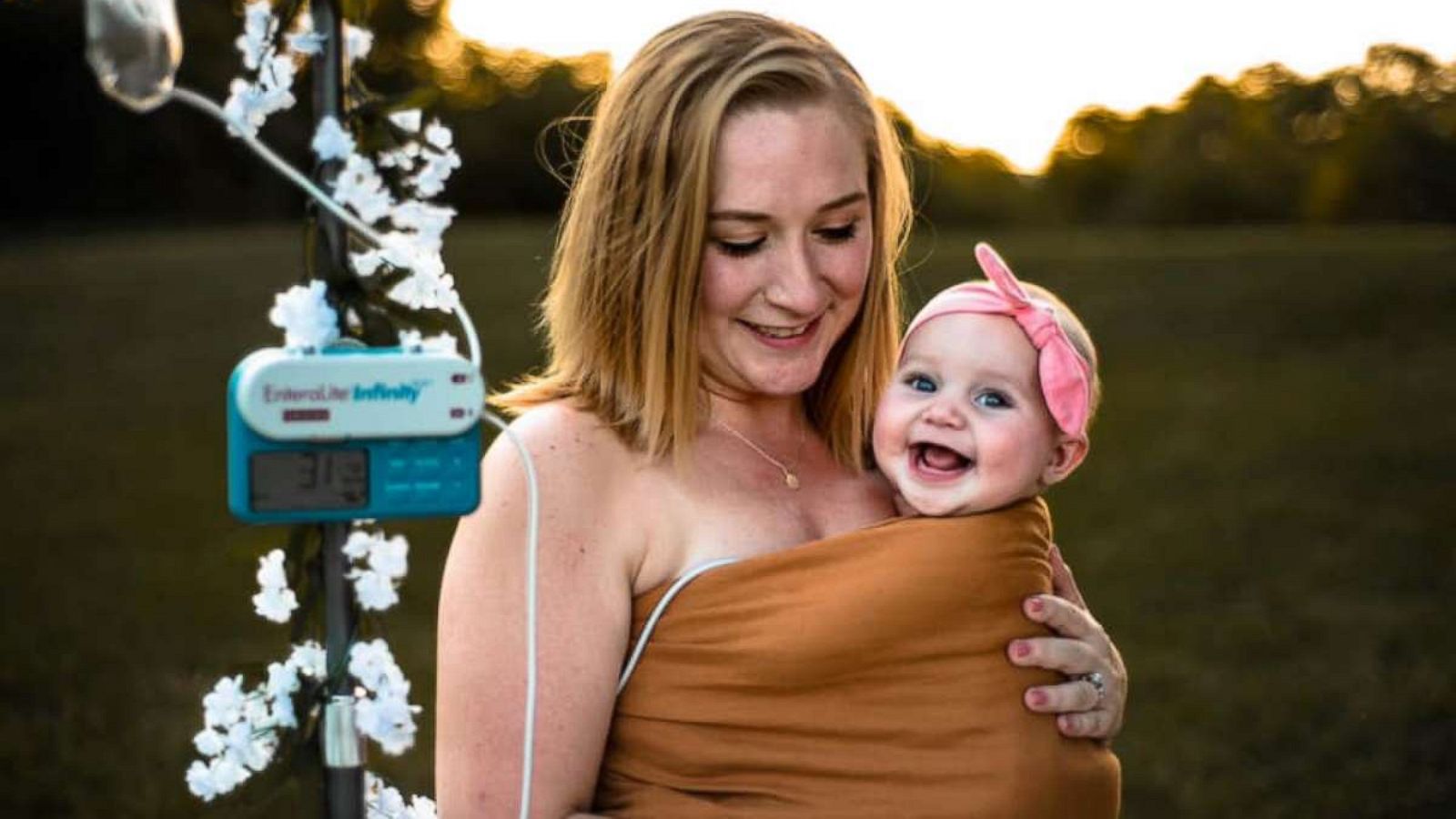 PHOTO: Anna Stacy Photography held a photo shoot with babies fed by tube.