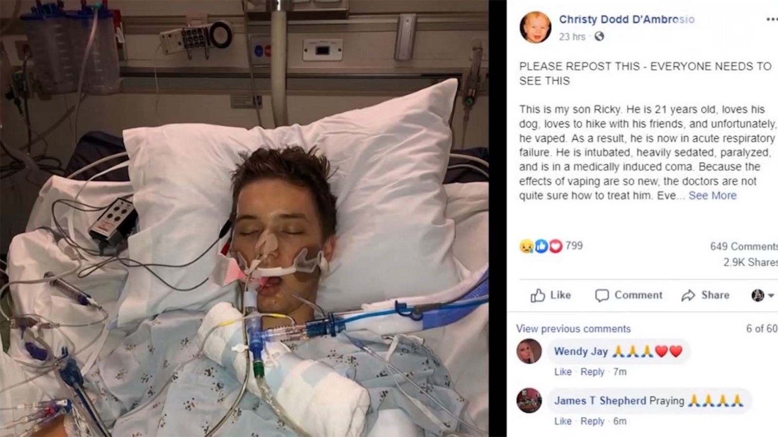 VIDEO: 21-year-old hospitalized in what doctor says was 'vaping-induced lung injury'