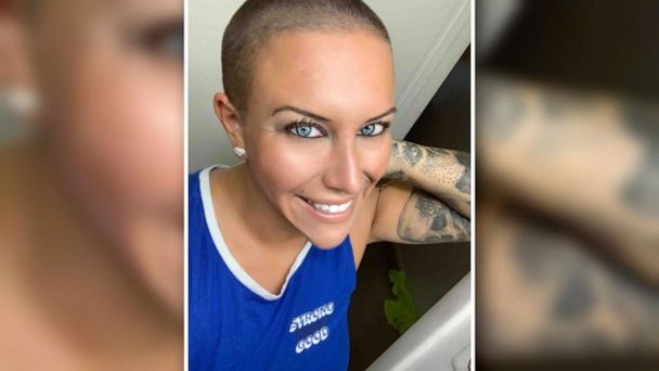 Video Woman Charged With Pretending To Have Cancer Abc News