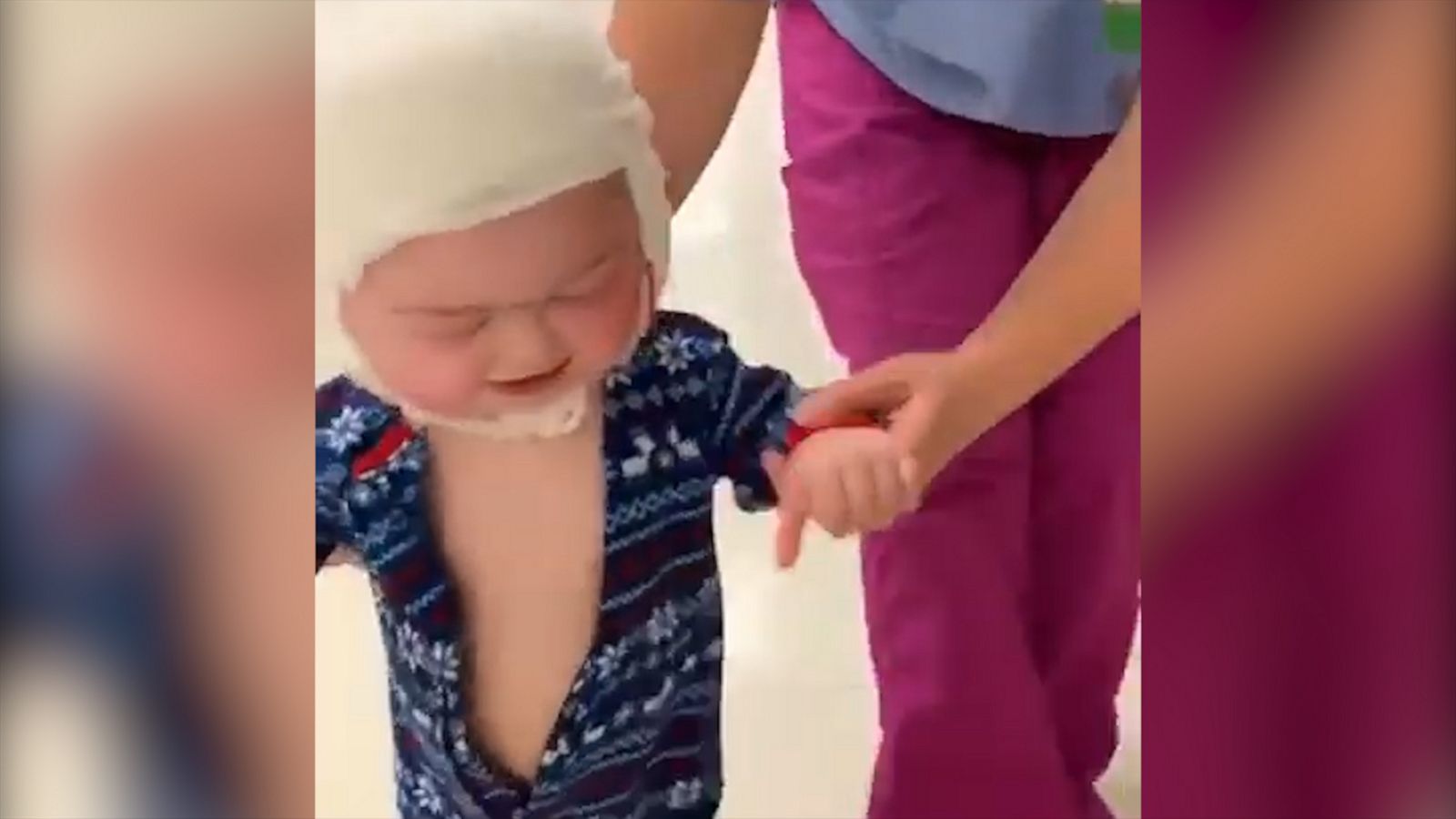 VIDEO: Emotional video shows toddler taking first steps since surgery