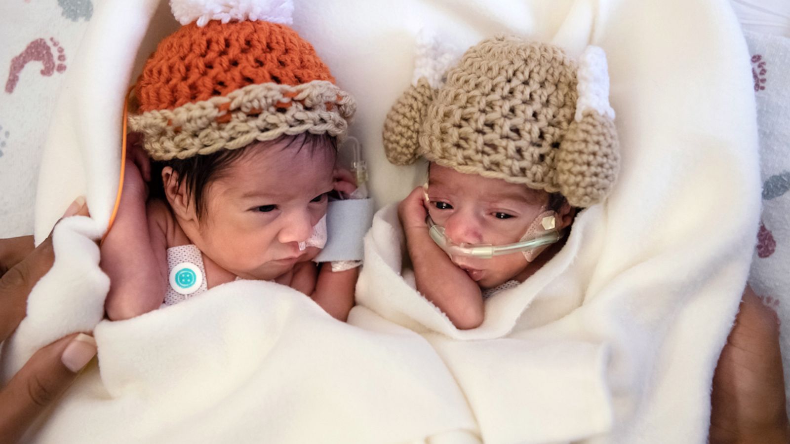 VIDEO: Hospital welcomes 12 sets of twins at once setting possible record