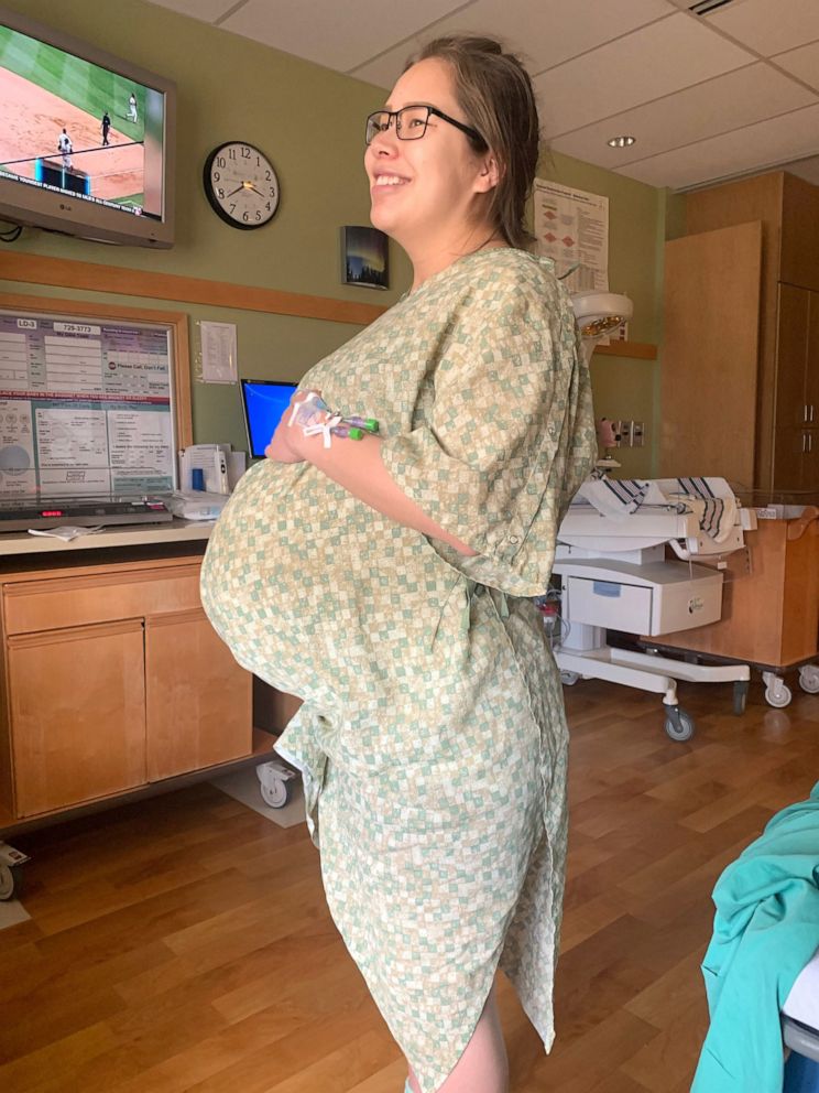 PHOTO: Cara Lestenkof-Mandregan poses in the hospital before giving birth to twin daughters Anna and Mila.