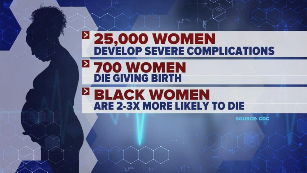PHOTO: Around 700 women die as a result of pregnancy or delivery complications in the U.S. each year, according to the CDC.