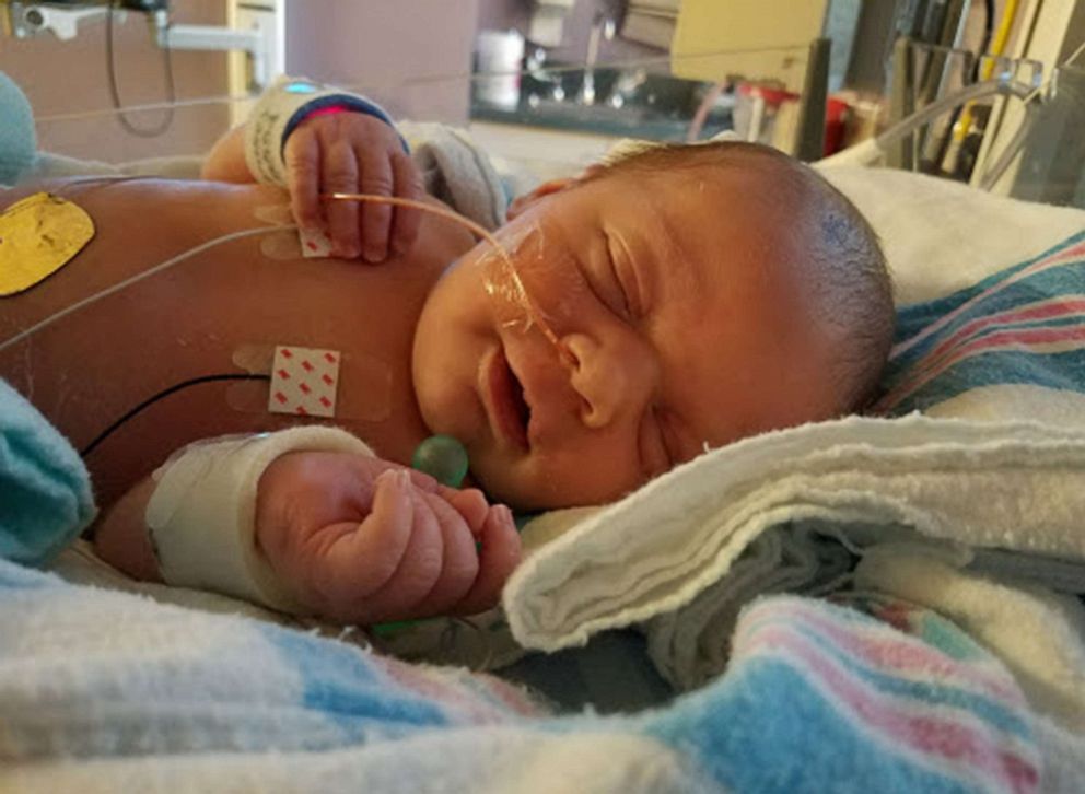 PHOTO: Brody Moreland was born with spina bifida. Brody also has a second condition called spinal cord atrophy and is paralyzed from the chest down.