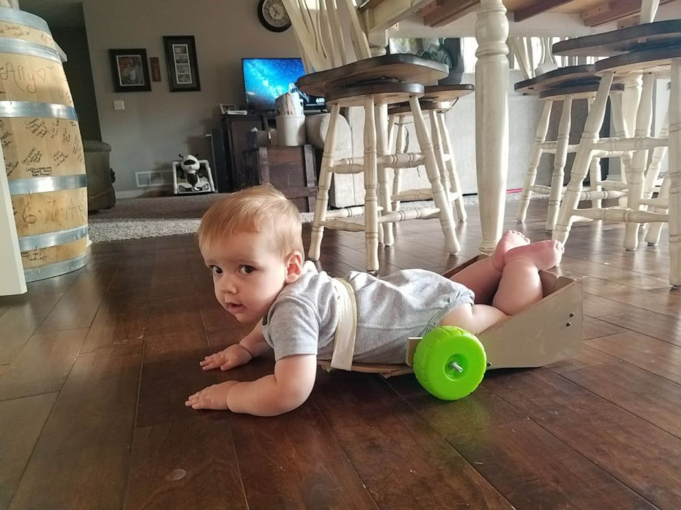 PHOTO: Brody was born with spina bifida and was also diagnosed with a second condition called spinal cord atrophy, which limits brain signal from going below his chest. 