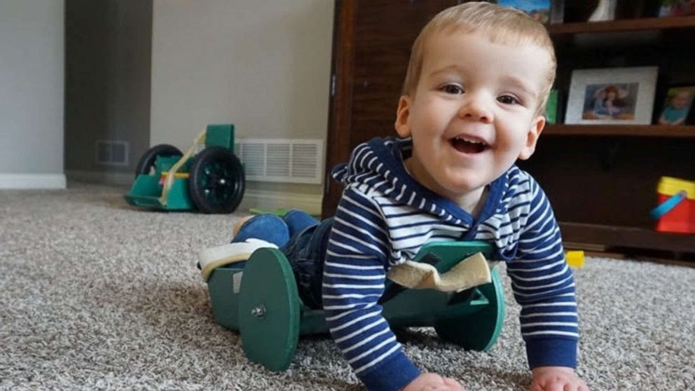 PHOTO: Brody Moreland, 2, of Centralia. Mo., was born with spina bifida and also has spinal cord atrophy and is paralyzed from the chest down.