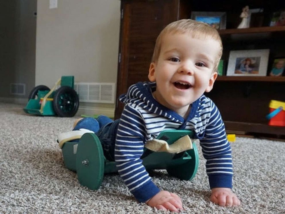 PHOTO: Brody Moreland, 2, of Centralia. Mo., was born with spina bifida and also has spinal cord atrophy and is paralyzed from the chest down.