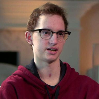 PHOTO: VIDEO: 17-year-old speaks out after double lung transplant due to vaping