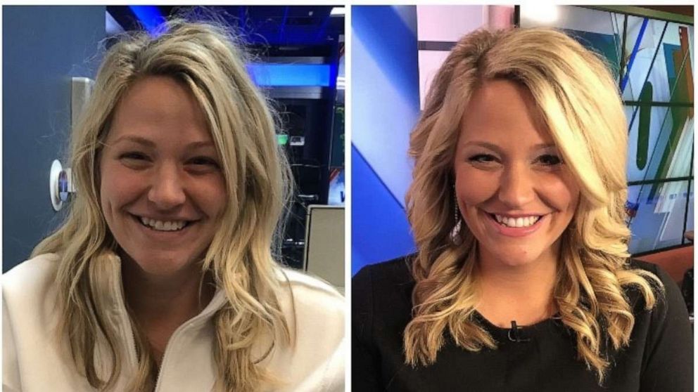 News anchor Deanna Falzone shared before and after photos of herself on social media.