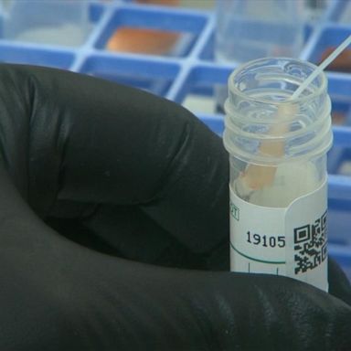 VIDEO: Coronavirus tests in the US, how it works and where to get one