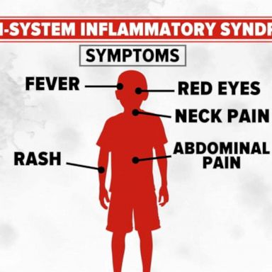 VIDEO: New warning as young adults contract rare inflammatory disease