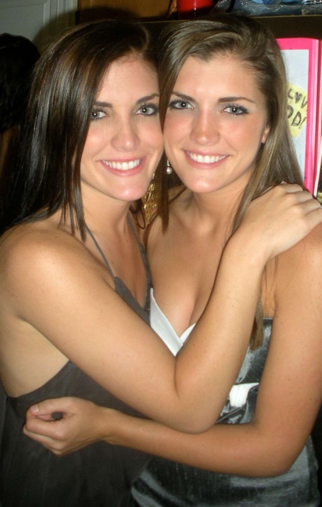 PHOTO: "It was the most unconditional love," Amy said of her relationship with her twin sister Ashley.