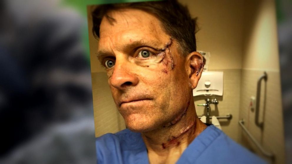 VIDEO: Man who survived bear attack speaks out