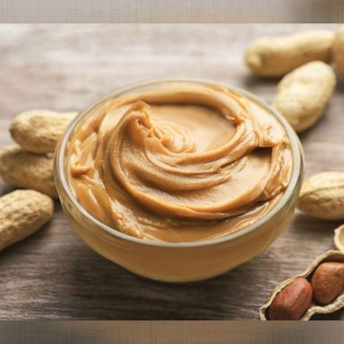 VIDEO: Alarming study finds pediatricians aren’t following guidelines on peanut allergies