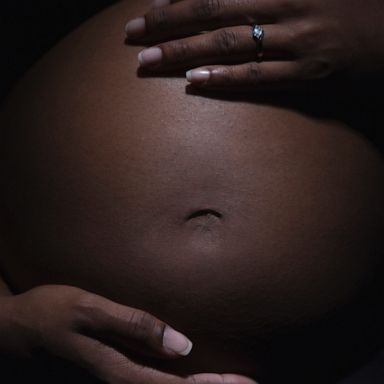 VIDEO: In the United States each year about 700 women die due to pregnancy related cause