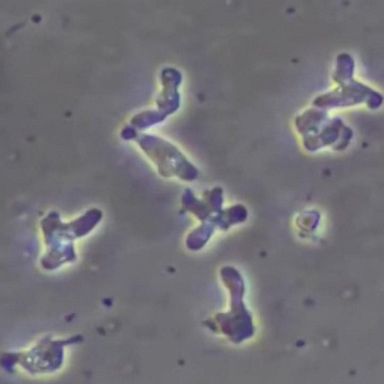 VIDEO: Disaster declaration after brain-eating amoeba found in water