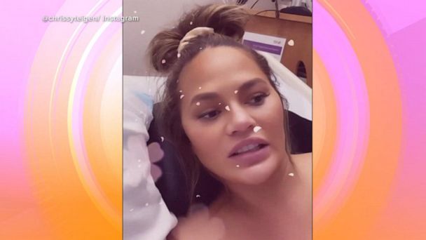Pregnant Chrissy Teigen hospitalized after excessive bleeding - Los Angeles  Times