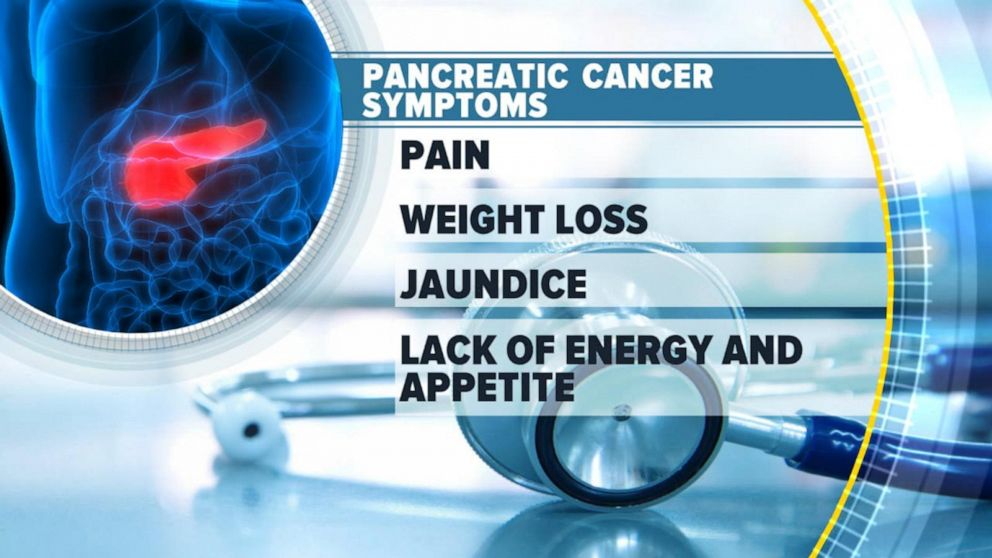 VIDEO: What to know about pancreatic cancer
