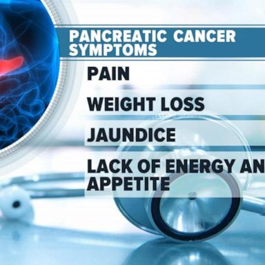 VIDEO: What to know about pancreatic cancer