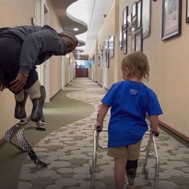 VIDEO: I’m not crying, you are! Watch as this amputee toddler walks for the first time